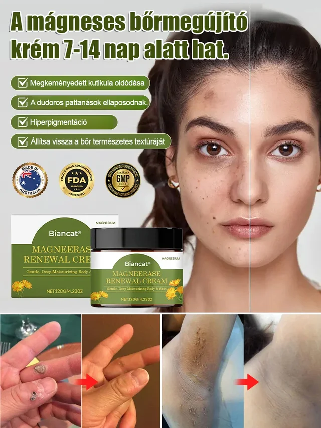 non medical skin renewal cream