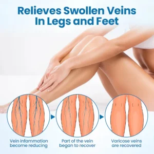 AnnieCare®Natural Herbs Strength Varicose Vein Capsules