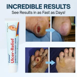 diabetic skin ulcer care cream