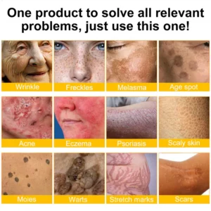 LOVILDS™ Bee Venom Skin Restoration Cream