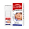 Cvreoz®Vitiligo Treatment Spray