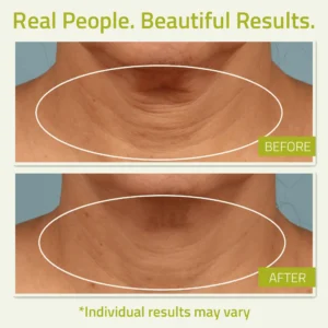 Neck Firming Cream with Green Tea and Vitamin C