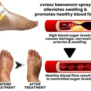 cvreoz bee venom foot care spray