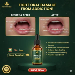 Mouth Opener Tool with Herbal Care Oil jaw exercise kit