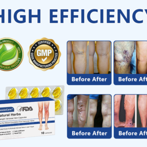 Herbal Varicose Vein Support Capsules – Circulation & Leg Relief
