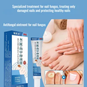 Anti-Fungal Nail Repair Cream – Clear, Healthy & Strong Nails Formula
