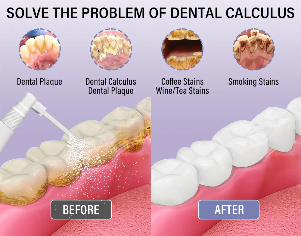 cosmetic oral hygiene spray