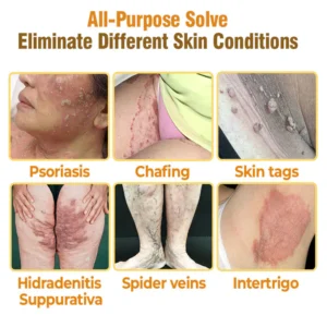 flysmus daily comfort cream