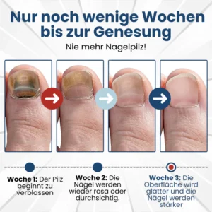 nail and cuticle care