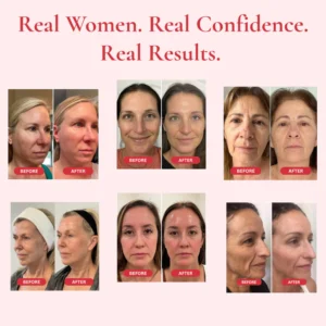 madeca skin care cream