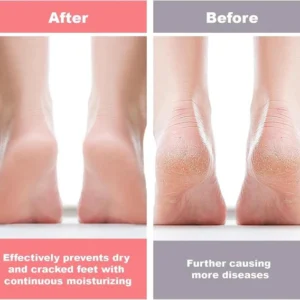 foot care silicone socks