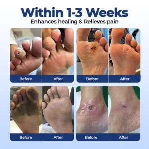 healrize daily foot care solution
