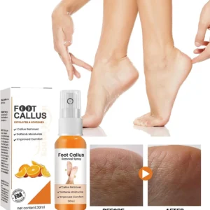 foot callus care spray