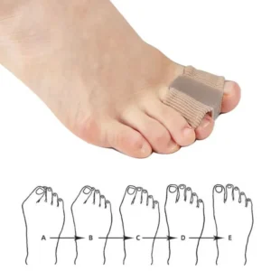 toe comfort separator