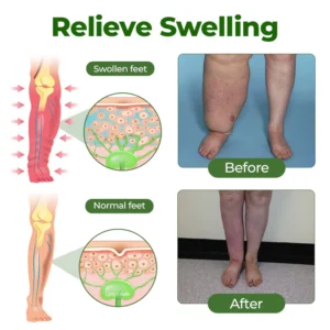 soothing leg refreshing mist timilk