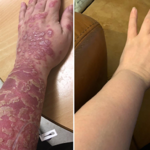 soothing cream for irritated skin