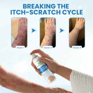 lbmlbm psoria-comfort magnesium mist