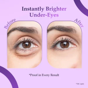 revitalizing eye patches for dark circles sanfe