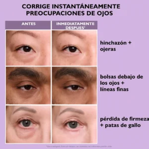 under-eye lifting effect formula