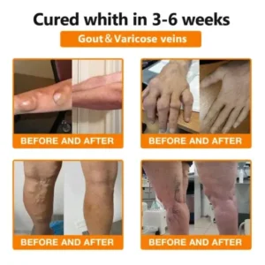 usa formula joint mobility gel bee venom plus