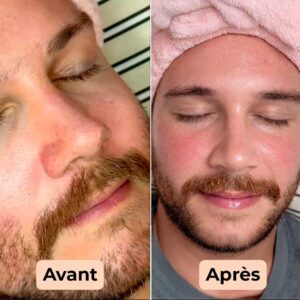 charcoal-based purifying face mask